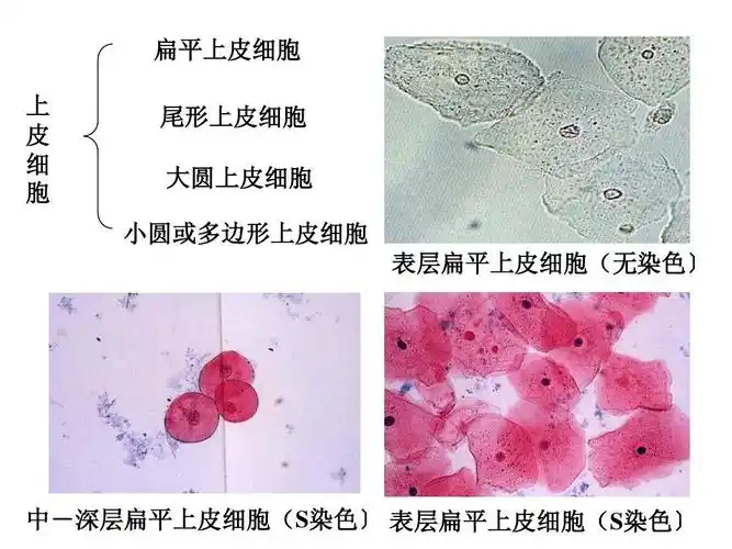 扁平上皮细胞 上 皮 细 胞 尾形上皮细胞 大圆上皮细胞 小圆或多边形