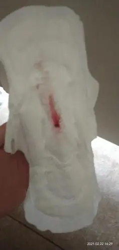 大姨妈量很少是什么问题啊有图慎点