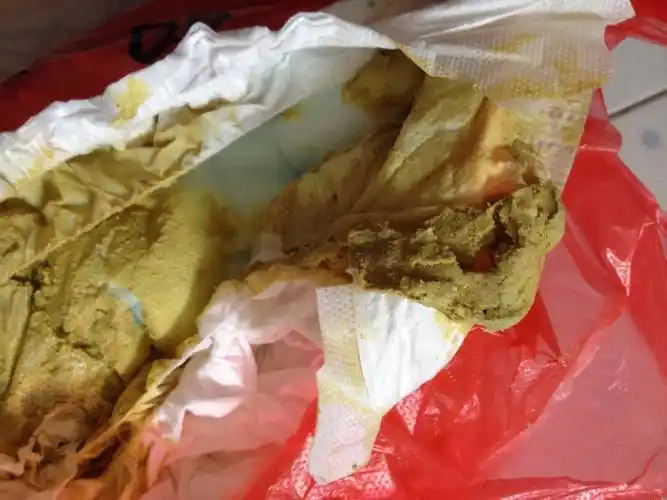 宝宝五个月了,今天突然拉这种颜色便便,这是不是所谓的陶土色便便,请