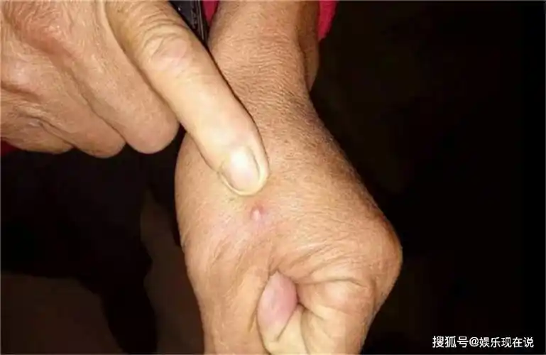 日本出现"剧毒"火蚂蚁,日本人慌了,专家:可能来自中国_手机搜狐网