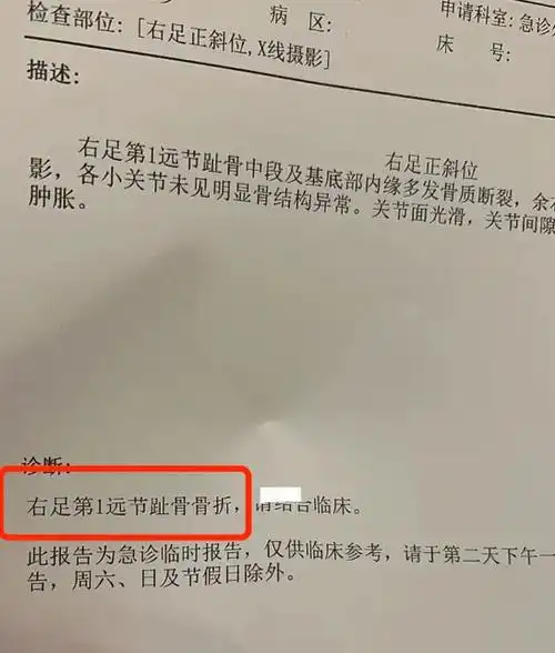 上海超模佟晨洁大脚趾骨折出脓血调侃自己蠢毙