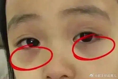 儿童健康守护者计划##脾胃虚弱##国医的精诚力量