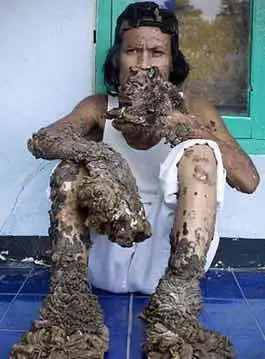 你见过现实生活中的树人吗印尼树人半人半树