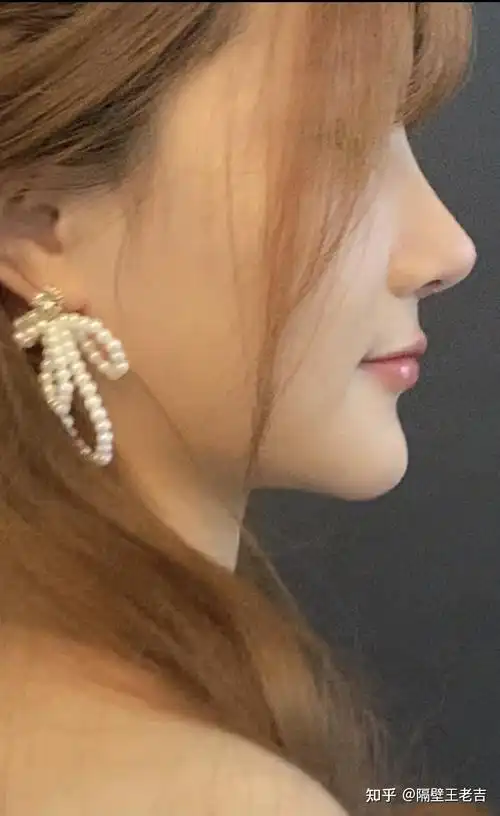 风格:直鼻微微偏翘的类型,洋气型.