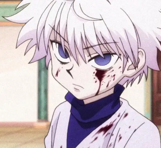 开心超人联盟|全职猎人人气王,真正的主角奇犽!