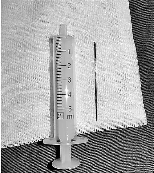 11岁小男孩将 6厘米长缝衣针放入尿道