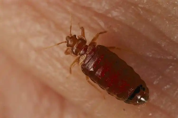 臭虫克星是什么?