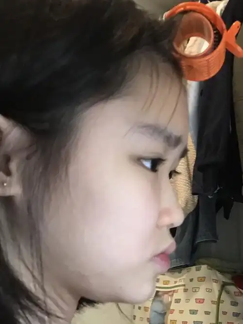鼻子很矮正面还好侧面真的好丑怎么办?
