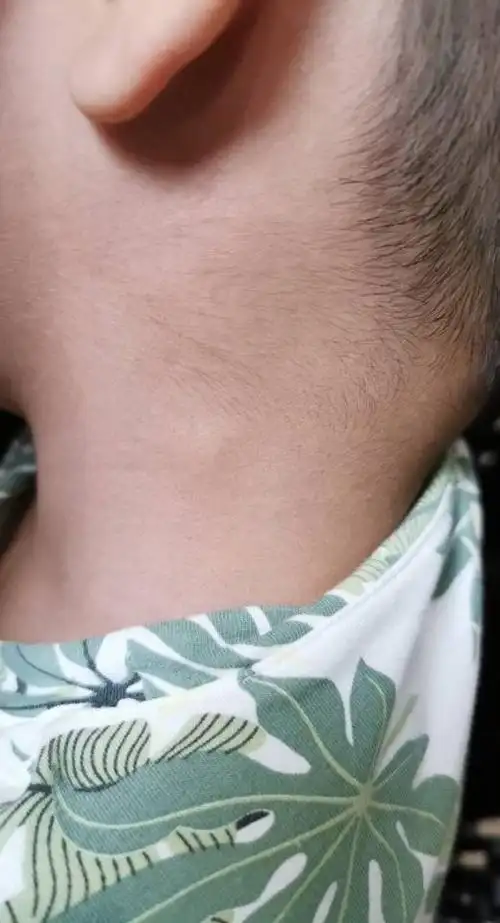 5岁孩子淋巴结肿大要紧吗