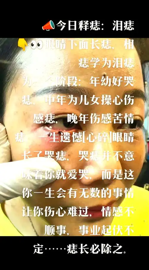 泪痣:一生情感与事业的三大阶段