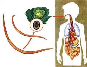 蛔虫病_治疗_症状_鉴别_蛔虫病专家免费咨询_快速问医生