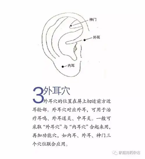 "耳鸣耳聋"的耳穴疗法