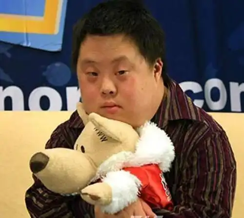 "唐氏宝宝"有预兆,这三类宝妈要注意,备孕期间能预防