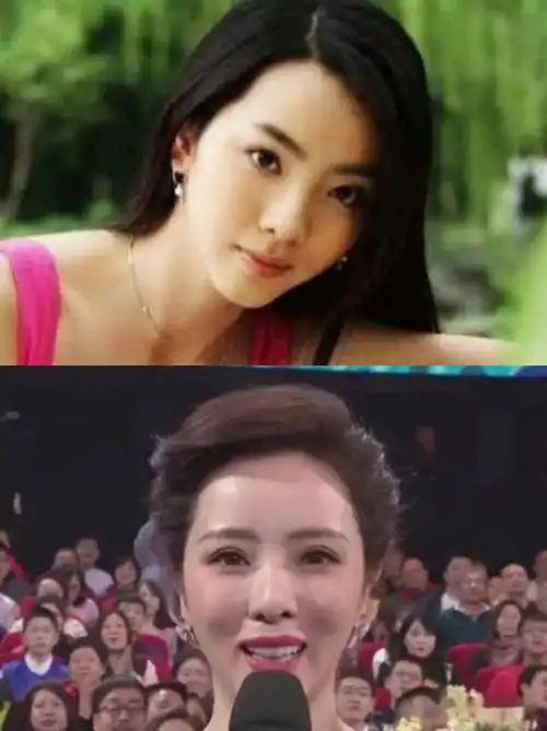 到底李思思整容整了哪些地方她的容貌都有哪些改变