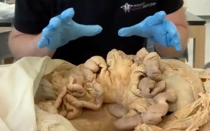 你的小肠有多长亲手上标本带你看