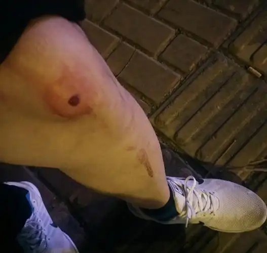 阜阳师范学院学生疑被气qiang打伤. 受访者供图