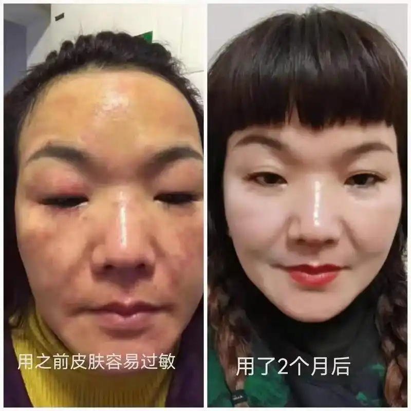 青春动能营养液 釆用"喷雾式"理念 打破注射型皮肤管理 突破 - 抖音