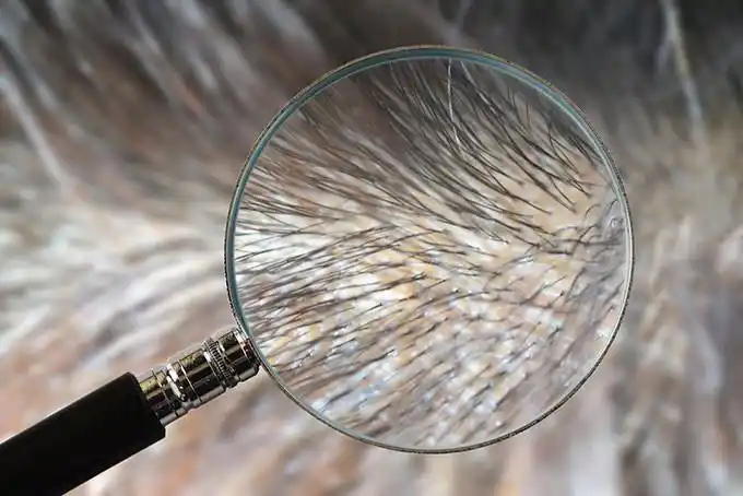 放大后的头发毛囊