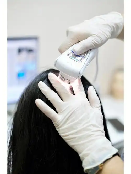 69头皮spa丨油头的头皮护理太重要啦60