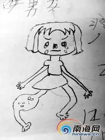 画骨骨瘦如柴的人物简笔画瘦子女孩简笔画骨瘦如柴男孩简笔画骨瘦如柴