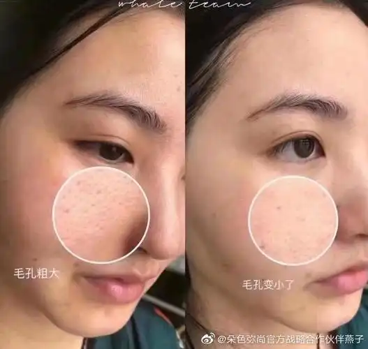 抗糖化可以吃美白片吗抗糖化护肤品可以美白皮肤呢弥尚护肤品抗糖