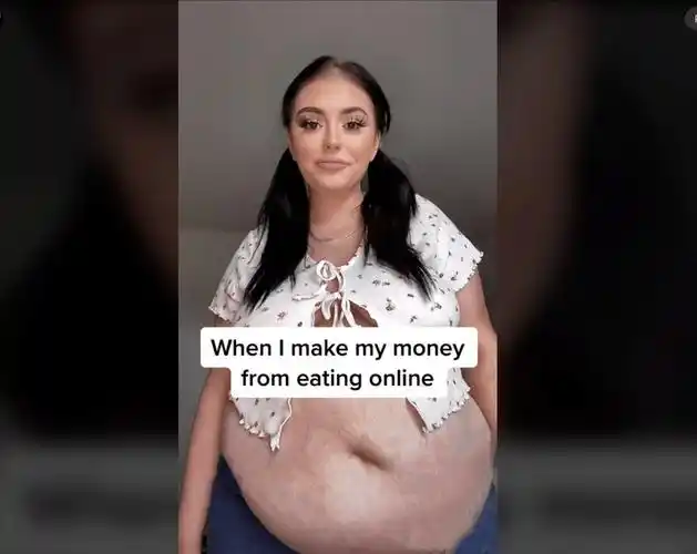 英国25岁妙龄女子瓜子脸却有罕见的巨大将军肚!_肚子_封在_饭量