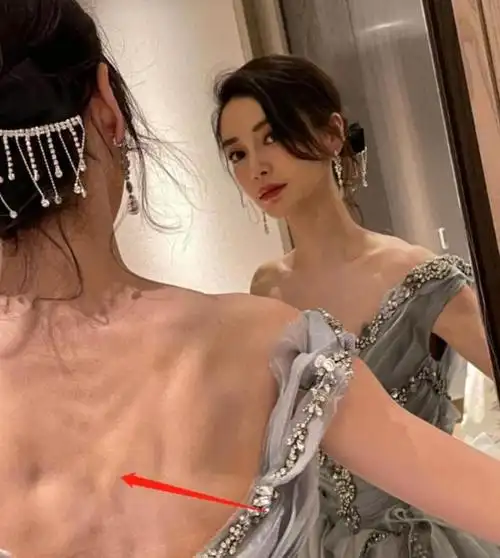 "瘦成竹竿,全身涂白,雌雄难辨"?娱乐圈的"病态审美"该停了