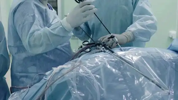 腹腔镜下的腹部手术图片