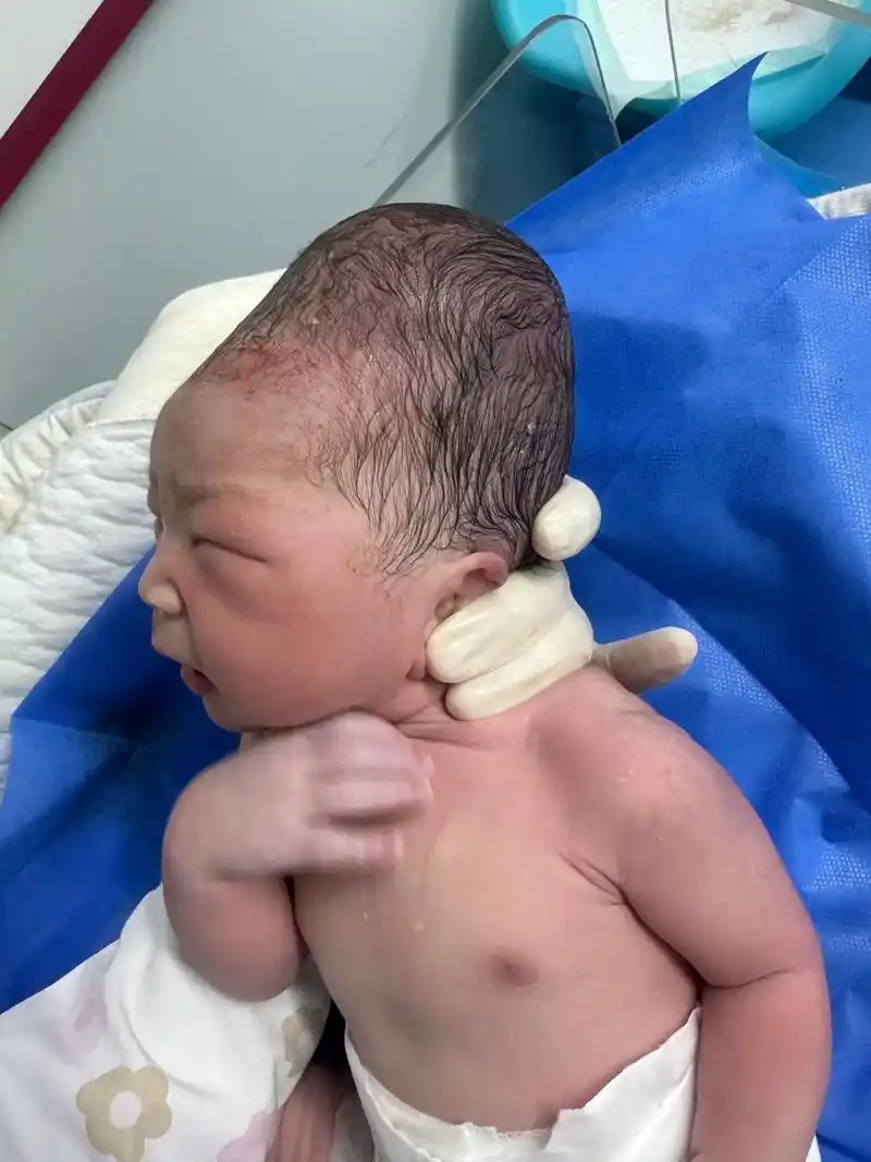 虽然枕后位顺产的很少,但也不是没有的,这就是枕后位顺产宝宝, - 抖音