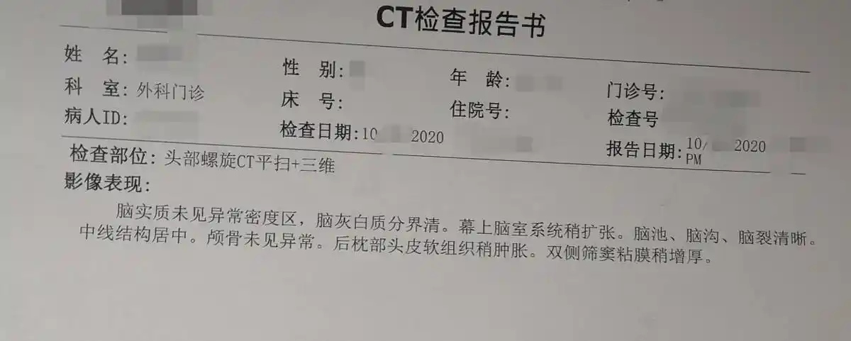 轻微脑震荡怎么办轻微脑震荡25天了还头昏头疼