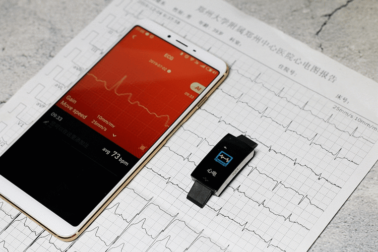 埃微i7e能监测心血图和血压的智能手环