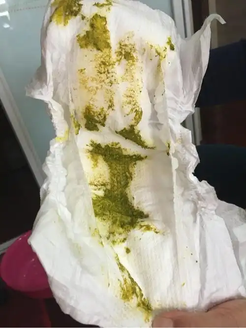 急 新手妈妈 亲们帮帮忙 宝宝绿色便便 有图慎入