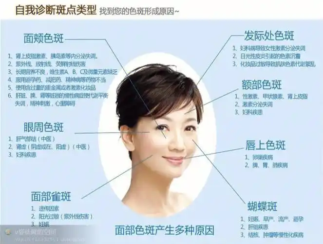 一张图教你如何自测脸部斑点类型