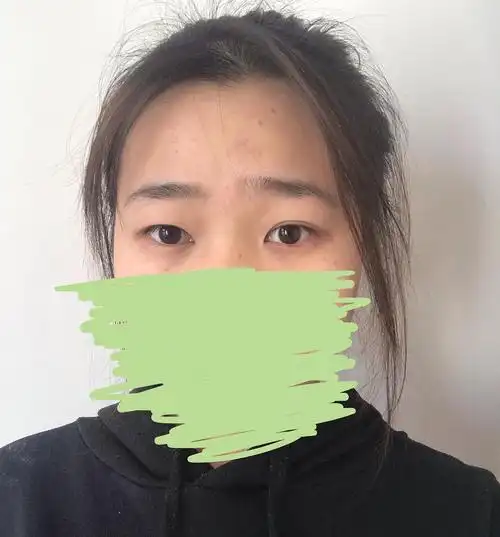 眉毛一高一低 还老被人说是囧字眉 现实生活中看还好,但是一拍照就