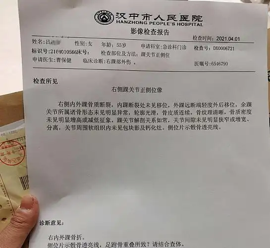 经过医生诊断,陶母右脚内外踝骨折