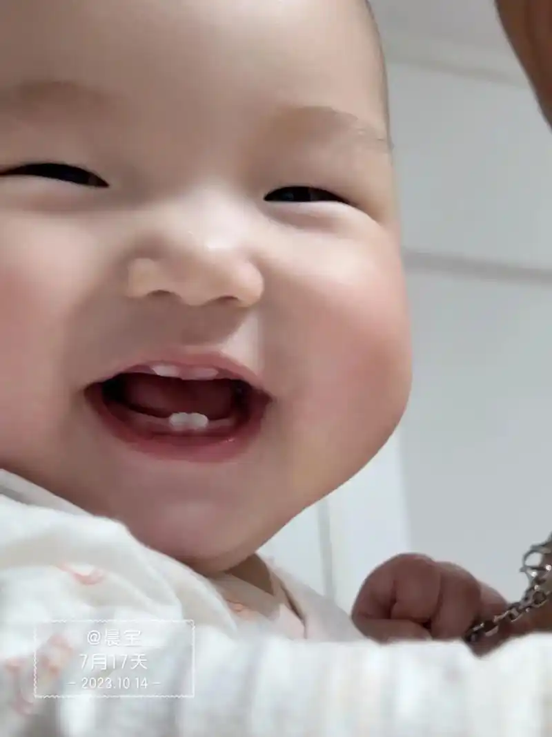 宝宝长牙齿了 上牙两颗都冒出来了七个月十七天的宝贝7315 - 抖