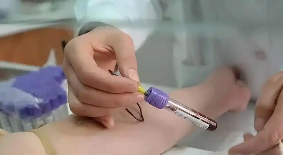 为什么抽血的管子,是五颜六色的?奇奇怪怪的知识又增加了