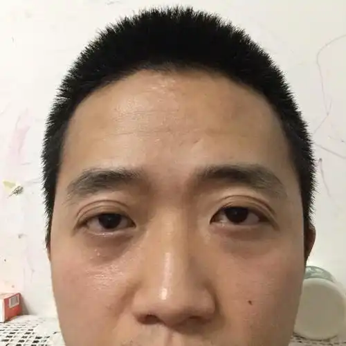 也不知道什么时候开始,右眼比左眼要低很多_平时不是很明显,不注意