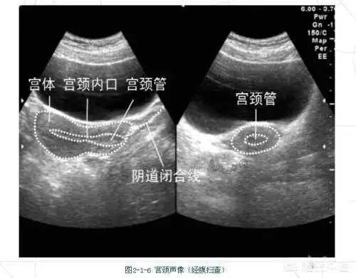 医生能否检查出患者曾经打过胎?区别还是有的!