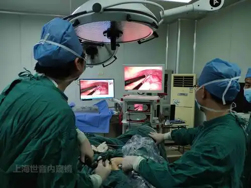 囊肿剥除术指腹腔镜下完全剥离卵巢囊肿保留余下正常卵巢组织的手术