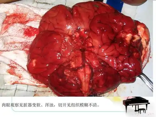 法医学-尸体现象ppt