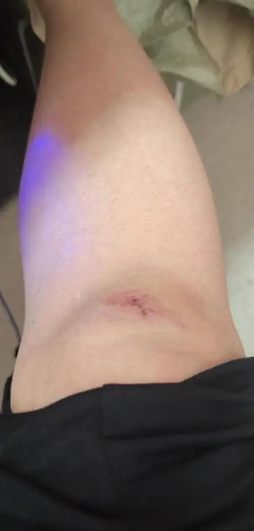 大家,骑电动车要小心要一点,防止车打滑