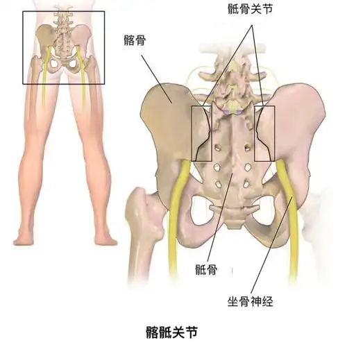 腰痛的病史 原图来源:wikimedia commons中文制图:sisfit_starr 骶髂