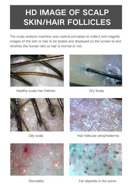 美凯特双镜头高清屏幕毛囊检测头发分析仪美容美发分析机