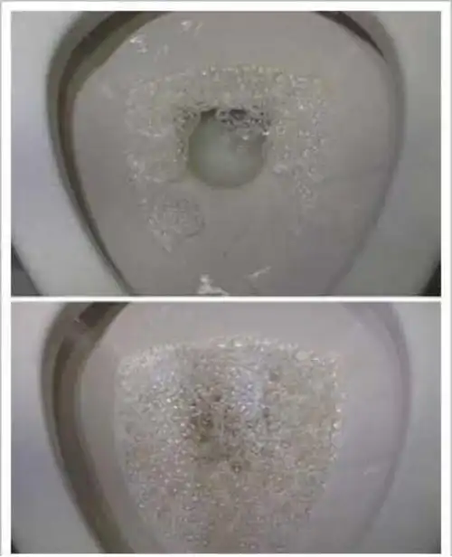 生血养发胶囊作用与功效