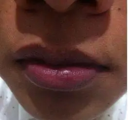 嘴唇发紫嘴唇发紫是身体哪里不好