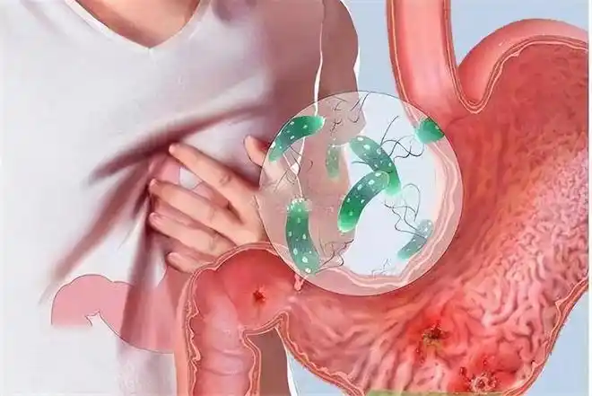 胃癌早期不痛不痒医生身体出现3个症状或是暗示癌症来临