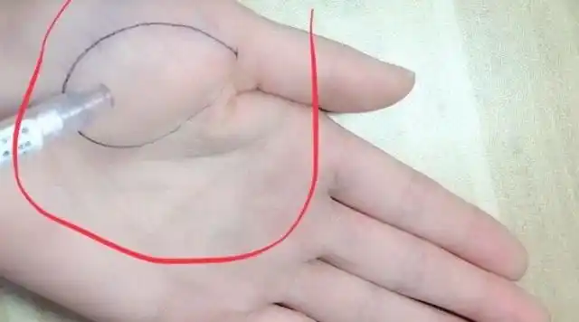 金星丘饱满的人,都有让人羡慕的财运,你的手相是这样的吗