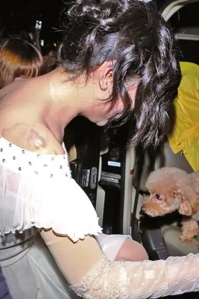 selina肩膀伤疤曝光(组图)