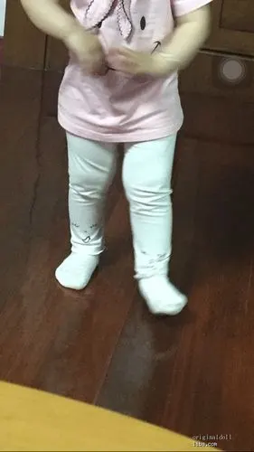 宝宝快20个月了,这算x型腿嘛